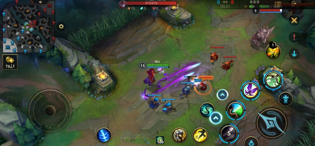 英雄联盟手游 海岛对战阵容推荐